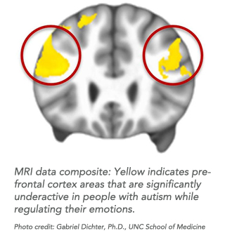 autism and emotion regulation