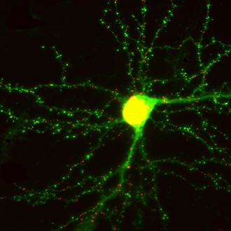 living neuron